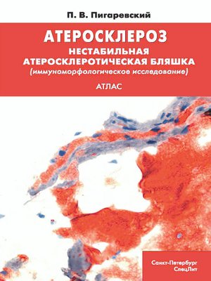 cover image of Атеросклероз. Нестабильная атеросклеротическая бляшка (иммуноморфологическое исследование)